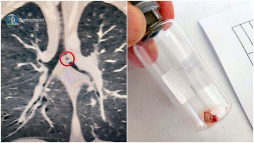 Малыш съел кусочек глины от деревенской печки и едва не задохнулся