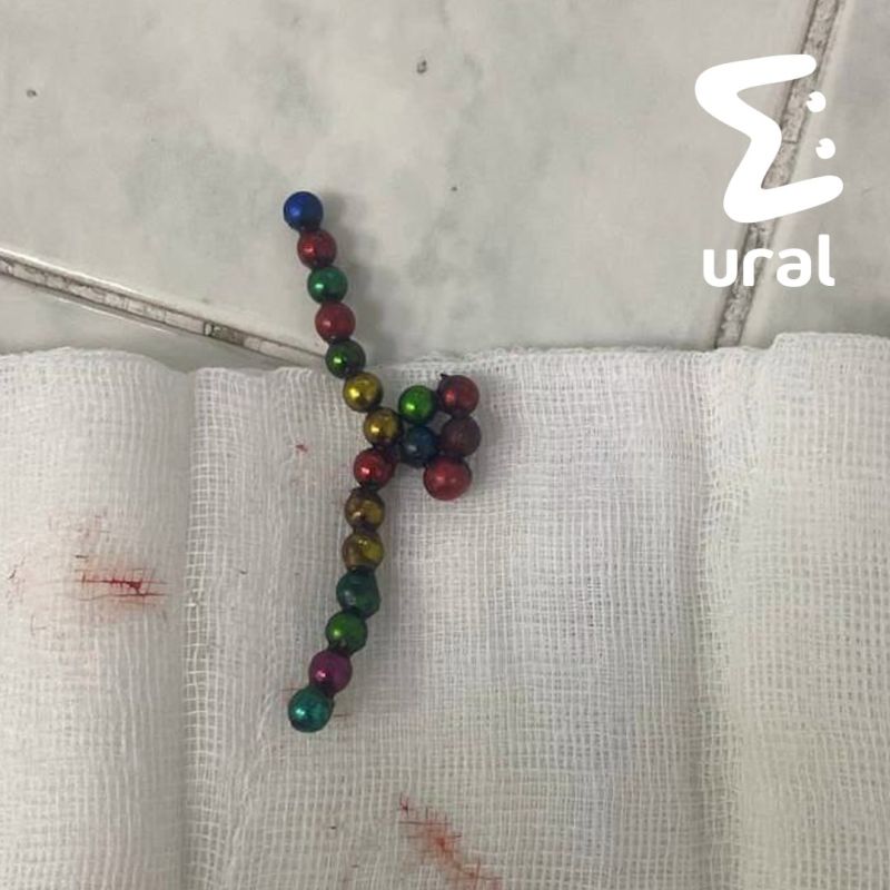 В ХМАО двухлетний мальчик проглотил магнитный конструктор и чуть не погиб