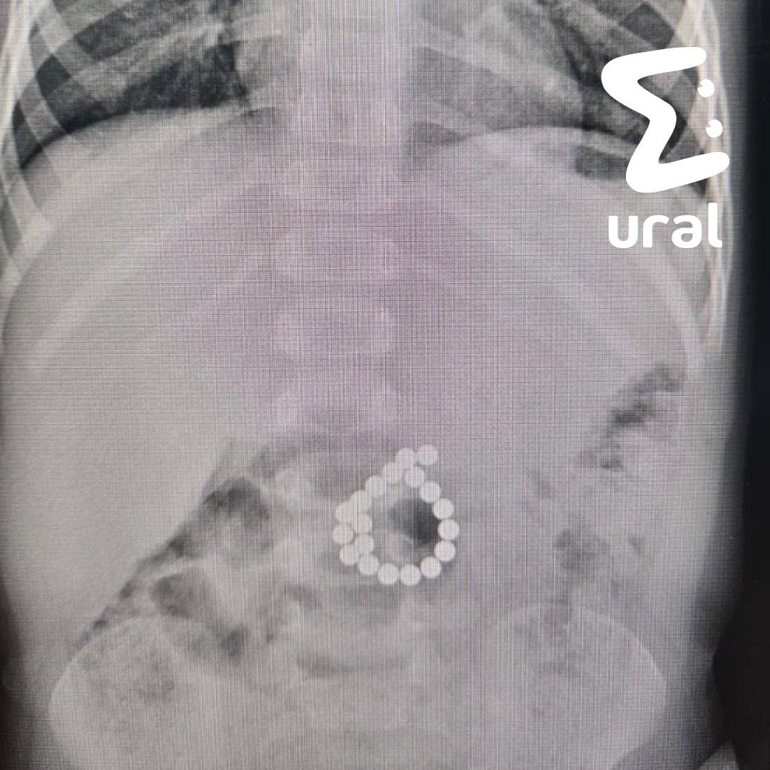 В ХМАО двухлетний мальчик проглотил магнитный конструктор и чуть не погиб В ХМАО двухлетний мальчик проглотил магнитный конструктор и чуть не погиб