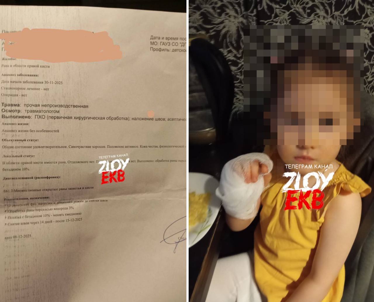 В Екатеринбурге ребенок получил порезы от вентилятора, встроенного в костюм аниматора В Екатеринбурге ребенок получил порезы от вентилятора, встроенного в костюм аниматора