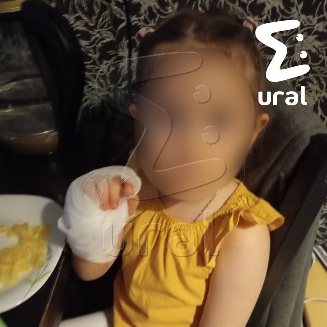 Девочка получила глубокие порезы во время танцев с аниматором-медведем на детском празднике в Екатеринбурге Девочка получила глубокие порезы во время танцев с аниматором-медведем на детском празднике в Екатеринбурге