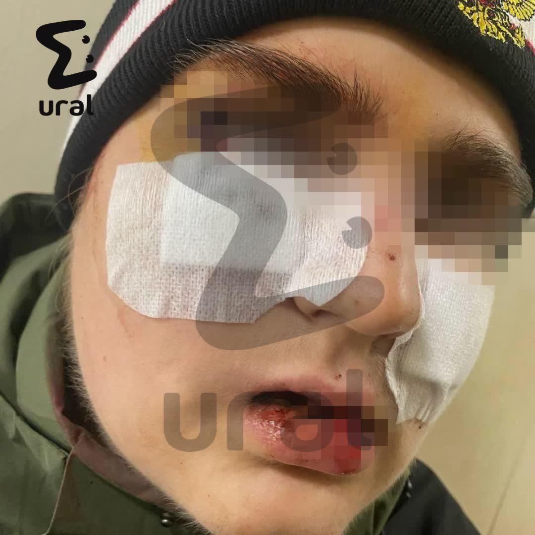 Кикбоксер жёстко избил восьмиклассника в Нижнем Тагиле