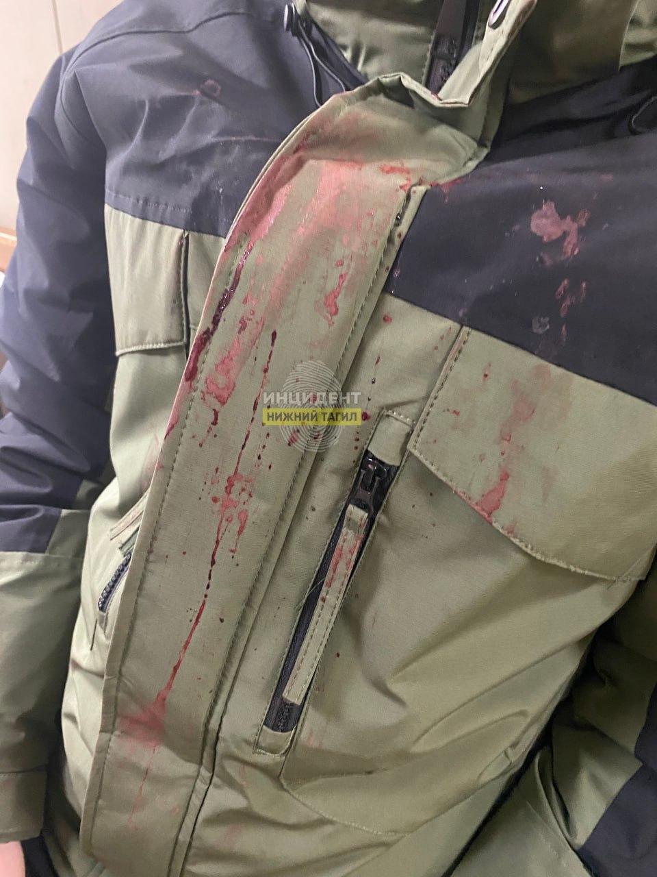 15-летний подросток избил ученика из своей школы — мальчик едва не лишился глаз 15-летний подросток избил ученика из своей школы — мальчик едва не лишился глаз