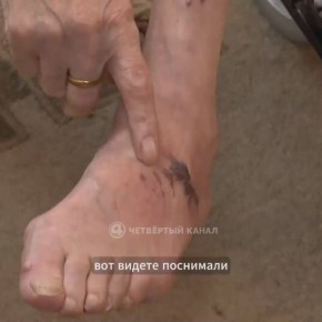 Пенсионер, лишившийся ноги под трамваем, учится жить заново – первое интервью после трагедии