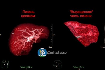 � ������������� ��������� ����� ������ ��� ���������� ��������