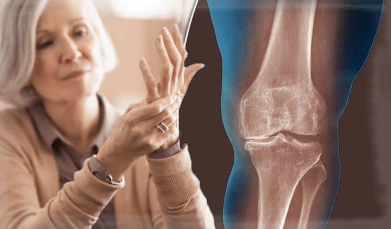 Что нужно знать о здоровье костей после 55 лет: советы и рекомендации