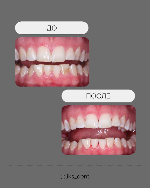 ����� ����� ���������� ������ �����?