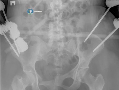 ����������� ��������� �������� �36 �������������������� � ������������� ������� � ����� 44-������ �������, ������� ����� � ��������� �����������