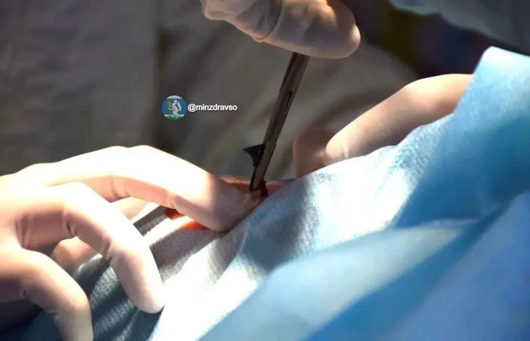 Саморез из глаза ребенка достали врачи в Екатеринбурге Саморез из глаза ребенка достали врачи в Екатеринбурге