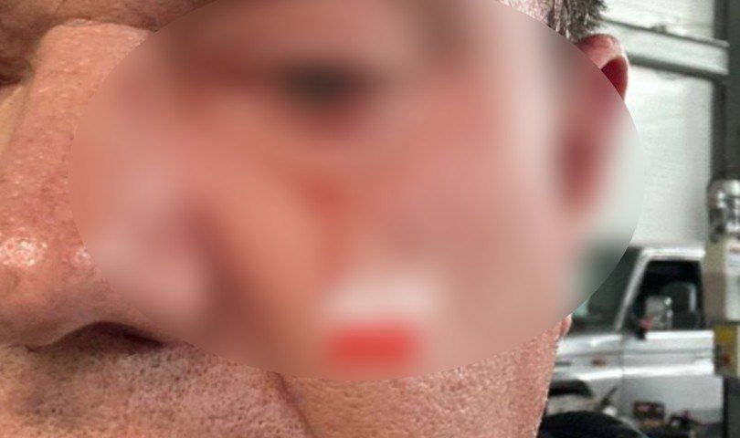 Автоэлектрик заявил о потере зрения после удара клиента в Екатеринбурге
