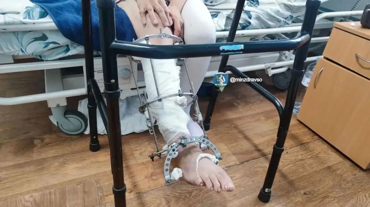 Уральские врачи спасли ногу женщине, которая попала под мотоблок Уральские врачи спасли ногу женщине, которая попала под мотоблок